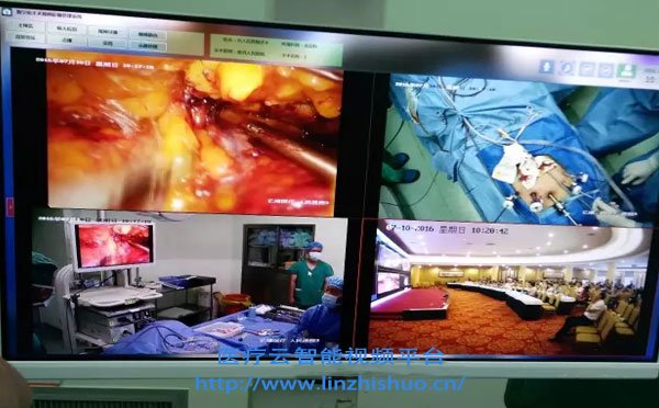 高清手術示教系統